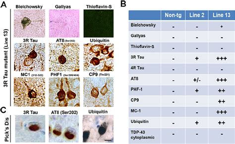 Histochemical And Immunocytochemical Characteristics Of The Aggregates