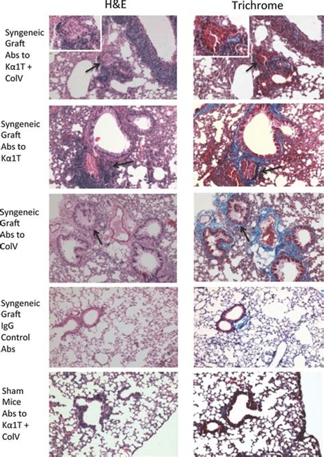 Representative histology on day 45 from mice that underwent syngeneic ...