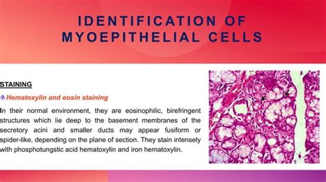 Pathophysiology Of Myoepithelial Cells In Salivary Glands PPT