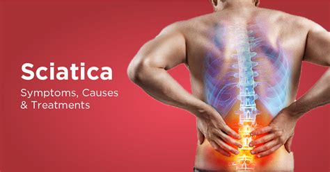 Symptoms Of Sciatica Buttock