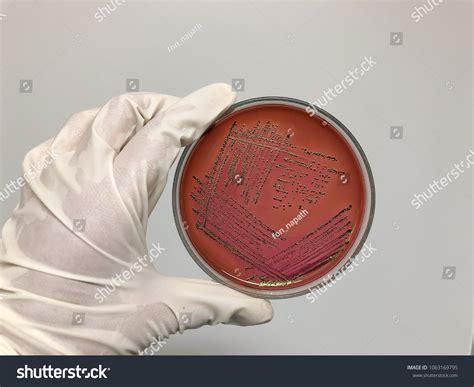 42 E Coli Lactose Test Images Stock Photos Vectors Shutterstock