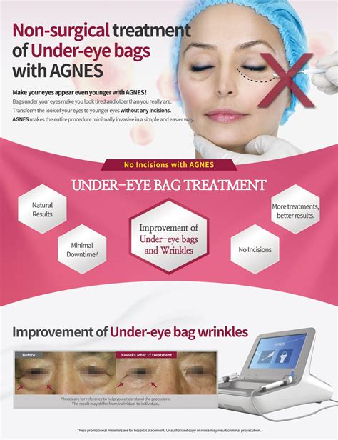 Eye Bag Removal Serenity MedSpa