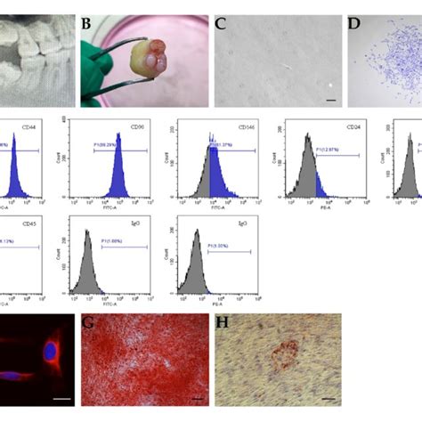 In Vitro Characterization Of Stem Cells From Apical Papilla Scaps