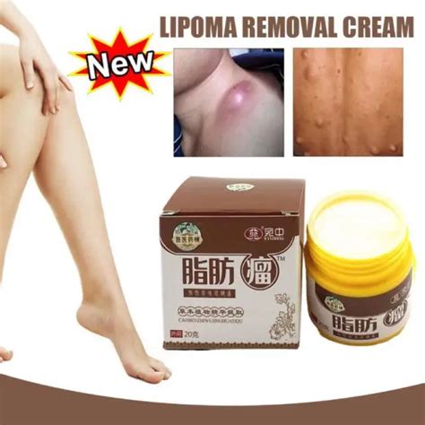 SOOTHING OINTMENT LUMPFREE Lipoma Removal Cream Fat Lump Removal EUR