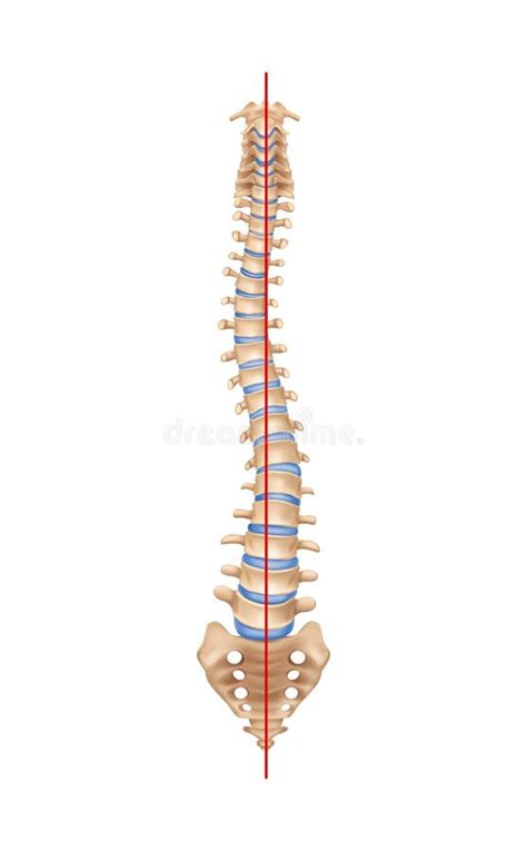 Composición Realista De Escoliosis En La Columna Vertebral Ilustración