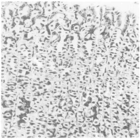 Plate 14 Glandular Stomach Of A Vehicle Control Male Swiss Cd 1® Mouse Showing No Lesions H