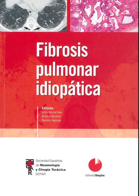 portada Portada libro Fibrosis Pulmonar Idiopática FPI Farmacosalud