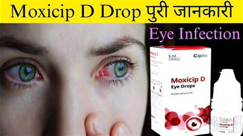 Moxicip D Eye Drop Moxifloxacin Dexamethasone Eye Drops Dose