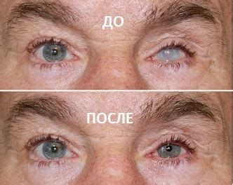 Док-Оптик. Индивидуальная окраска контактных линз (маскирующие). Главная.