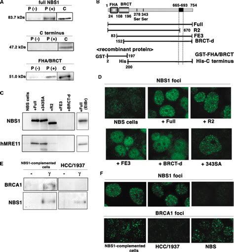 Nbs Localizes To H Ax Foci Through Interaction With The Fha Brct