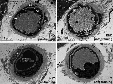 Transmission Electron Microscopy To Demonstrate The Ultrastructure Of