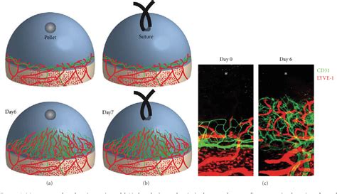 Figure 2 From Lymphatics And Lymphangiogenesis In The Eye Semantic