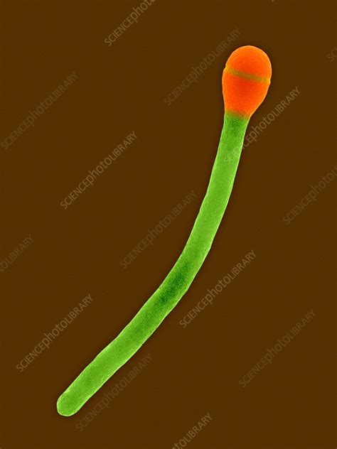 Clostridium Phytofermentans SEM Stock Image C032 2415 Science