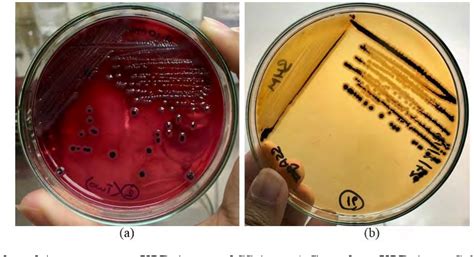 Xld Agar E Coli