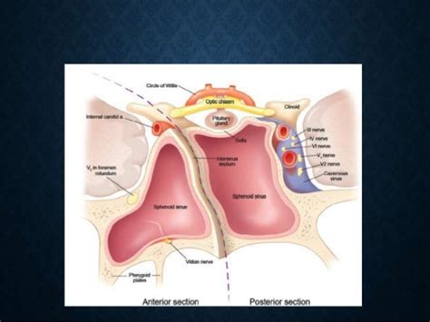 [diagram] Diagram Of Sphenoid Sinuses Mydiagram Online