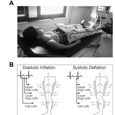 Pdf Enhanced External Counterpulsation And Short Term Recovery From