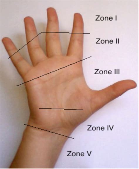 An Overview Of The Management Of Flexor Tendon Injuries