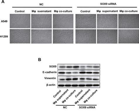 Tumor-associated macrophages promote tumor metastasis via the TGF-β ... 