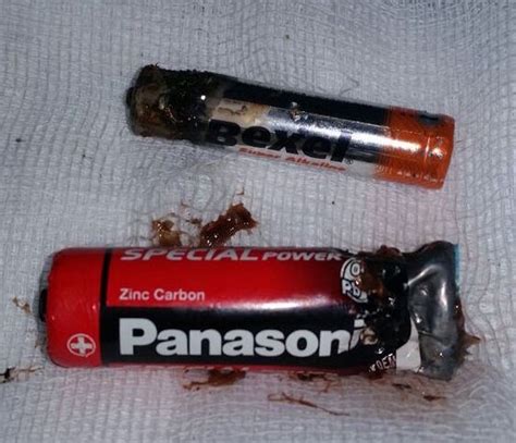 Ingestion Of Cylindrical Batteries And Its Management Bmj Case Reports