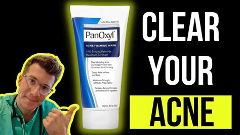 Doctor Explains How To Use Benzoyl Peroxide For Acne Aka Panoxyl