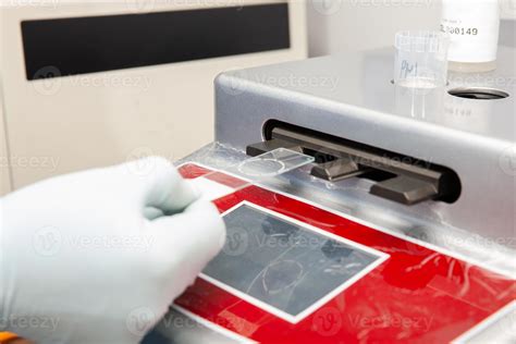 Scientist preparing microscope slides with liquid based cytology method