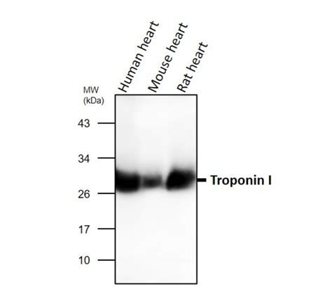 Cardiovascular Antibody Panel Irap Ireal Biotechnology Inc