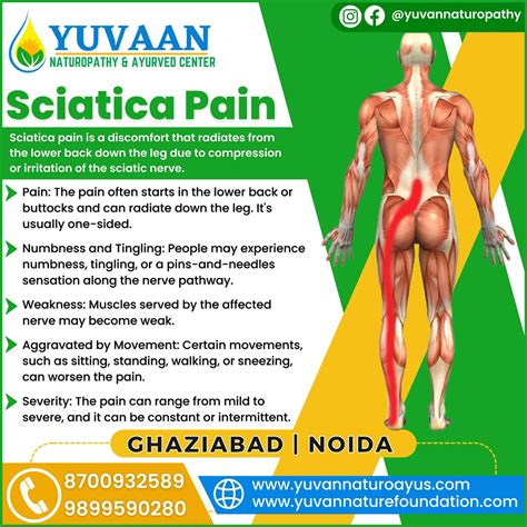 Sciatica Pain | Symptoms of Sciatica Pain - Yuvaan Nature Foundation