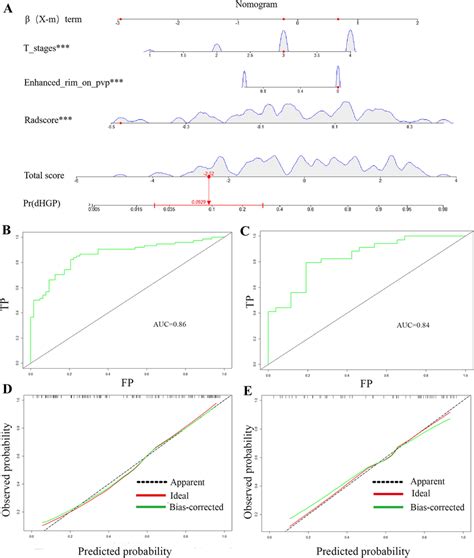 The Radiomics Nomogram And Its Performance A Constructed Nomogram For