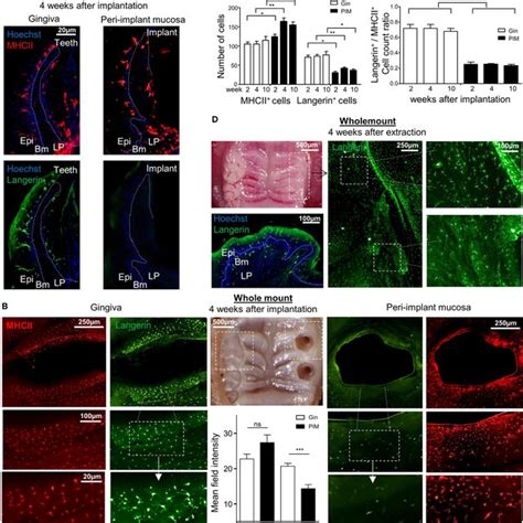 Visualization Of Langerin And Mhcii Expression In The Peri Implant