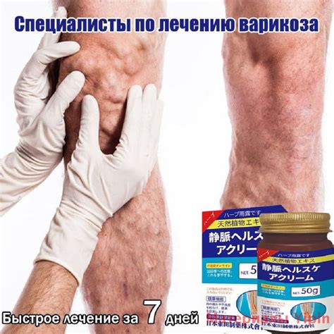 Крем от варикоза усталости и отеков ног охлаждающий,тонизирующий гель ...
