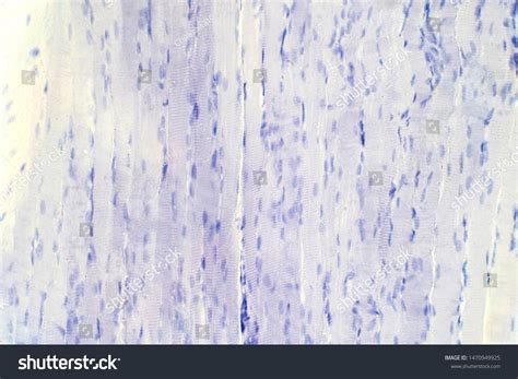 Human Skeletal Muscle Tissue Under Microscope Stock Photo 1470949925 | Shutterstock