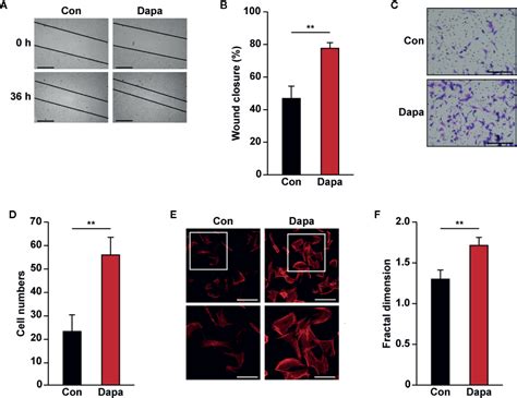 Frontiers Dapagliflozin Promotes Neovascularization By Improving