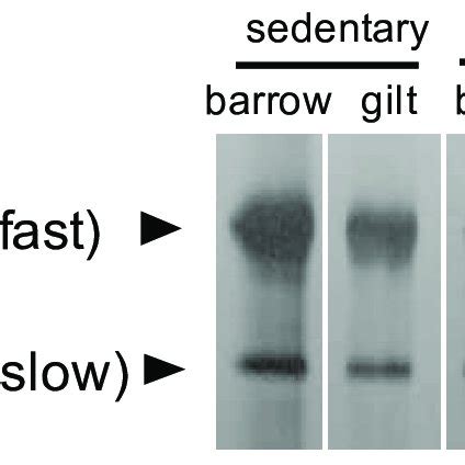 Separation Of Myosin Heavy Chain MyHC Isoforms Of The Porcine