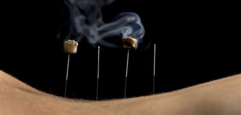 Moxibustion — Qandd Acupuncture And Herb Clinic