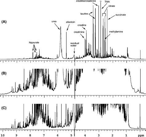 A A 1D Proton NMR Spectrum Of Urine Obtained From Abcc6 KO3 Mouse