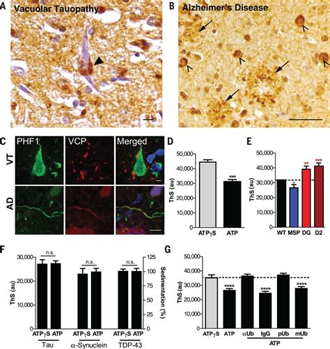 Autosomal Dominant Vcp Hypomorph Mutation Impairs Disaggregation Of Phf