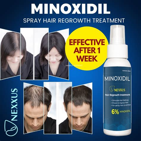 Minoxidil Nexxus 6 Minoxidil Topical Solution Hair Grower Beard Grower