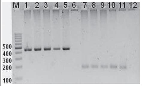 Figure 1 From Molecular Detection Of Entamoeba Histolytica And Entamoeba Dispar Infection Among