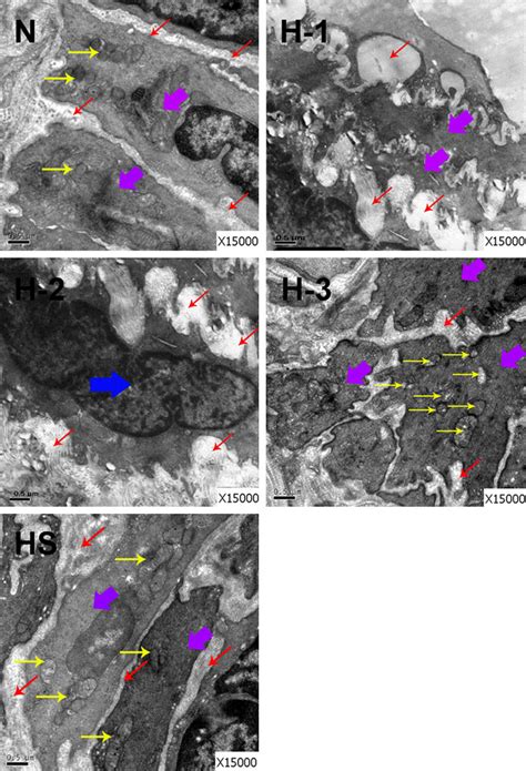 The Effect Of Salidroside On Hypoxia Induced Pulmonary Arterial