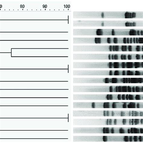 Dendrogram Of XbaI Mediated Restriction Mapping Of The DNA From The