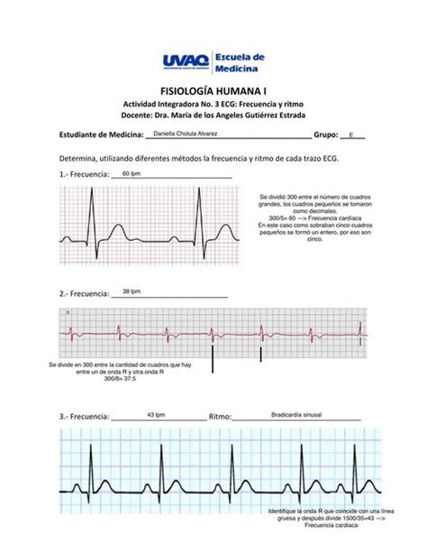 2E Actividad Integradora 3 ECG Daniella Cholula UDocz