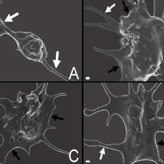 Representative Scanning Electron Micrographs Of Platelets From The