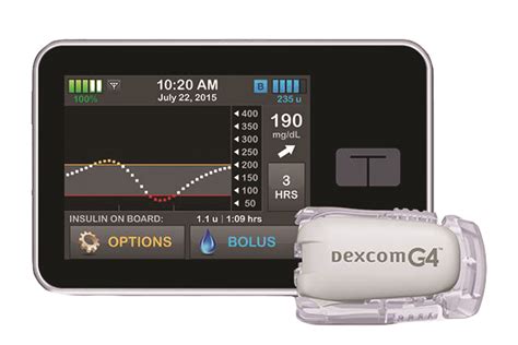 Insulin Pump Rundown