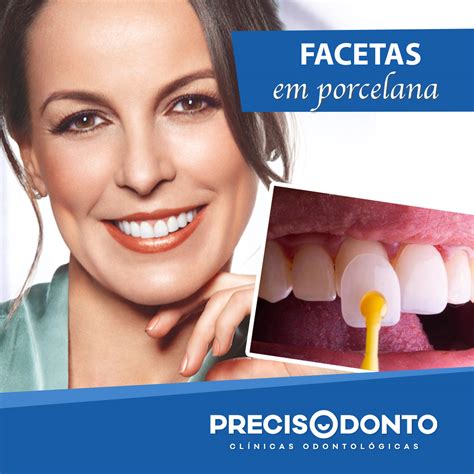 Saiba como ter um sorriso mais bonito as facetas dentárias