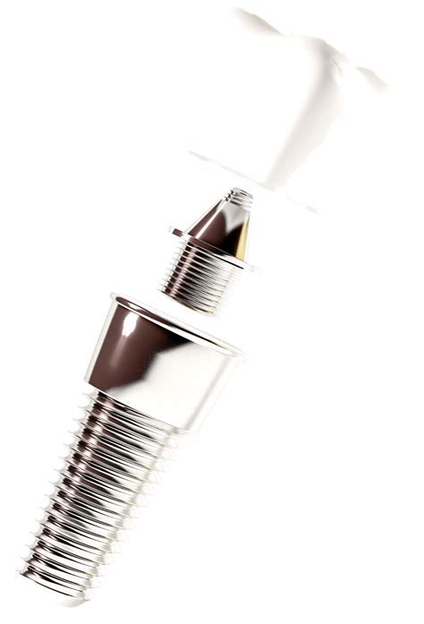 Новые зубы за 24 часа 149 000р в стоматологии Милан