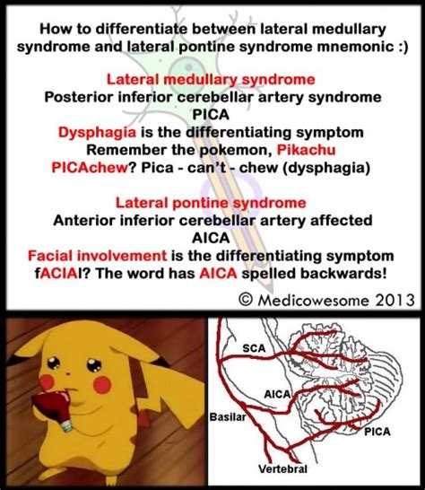 Medial Pontine Syndrome