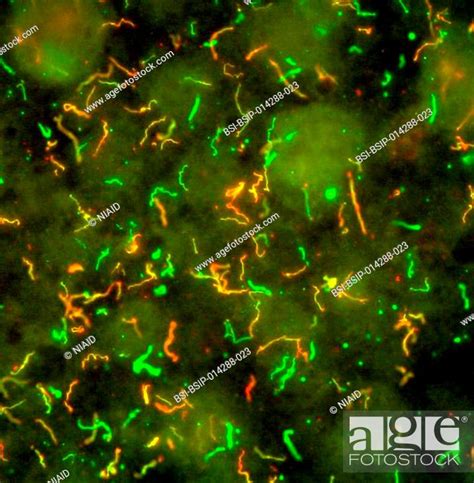 Lyme Disease Bacteria Borrelia Burgdorferi The Lyme Disease