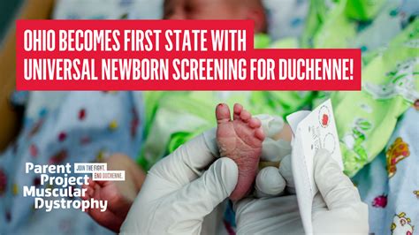 Duchenne Newborn Screening Milestonefirst State With Universal Newborn