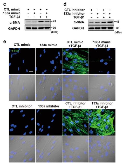 Lung Fibrosis Creative Bioarray Cellassay