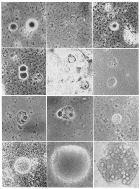 Upper Left Typical Blastocysiis Hominis Cells Of The Vacuolated Download Scientific Diagram